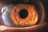 Das Auge - wichtigstes Sinnesorgan und Fenster der Seele.